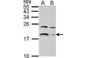 WB Image LC3B antibody detects LC3B protein by western blot analysis. (LC3B antibody)