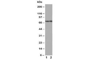 Western blot testing of ABCG4 antibody