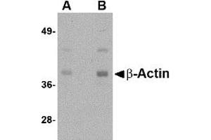 Western Blotting (WB) image for anti-Actin, beta (ACTB) (N-Term) antibody (ABIN1031271) (beta Actin antibody  (N-Term))