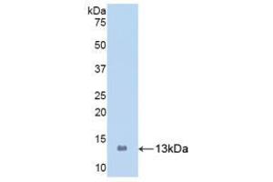 Western Blotting (WB) image for S100 Calcium Binding Protein A8 (S100A8) ELISA Kit (ABIN6574287)