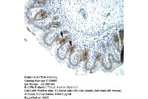 Human Stomach (ETV6 antibody  (C-Term))