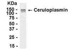 Western Blotting (WB) image for anti-Ceruloplasmin (Ferroxidase) (CP) (AA 1-1065) antibody (ABIN2467927) (Ceruloplasmin antibody  (AA 1-1065))