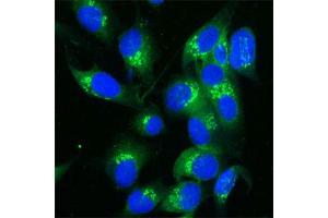 Human Melanoma cell line C 32 was cultured overnight on round cover slides placed in a 24 well tissue culture plate. (TGOLN2 antibody)