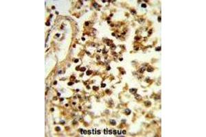 Immunohistochemistry (IHC) image for anti-Interleukin 31 (IL31) antibody (ABIN3004157) (IL-31 antibody)