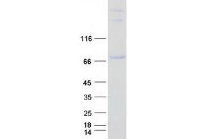 Western Blotting (WB) image for Runt-Related Transcription Factor 1, Translocated To, 1 (Cyclin D-Related) (RUNX1T1) (Transcript Variant 4) protein (Myc-DYKDDDDK Tag) (ABIN2731256)