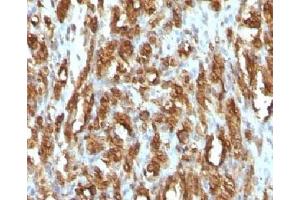 Immunohistochemistry (IHC) image for anti-Actin, alpha 1, Skeletal Muscle (ACTA1) antibody (ABIN3026689)