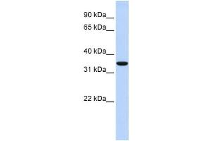 Western Blotting (WB) image for anti-Membrane-Associated Ring Finger (C3HC4) 1, E3 Ubiquitin Protein Ligase (MARCH1) antibody (ABIN2458722) (MARCH1 antibody)