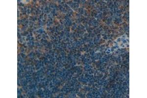 Immunohistochemistry (IHC) image for anti-Linker For Activation of T Cells (LAT) (AA 30-237) antibody (ABIN1859615)