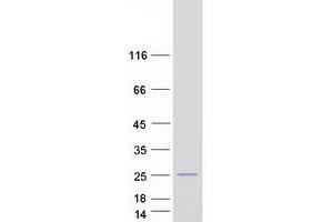 FLYWCH Family Member 2 (FLYWCH2) (Transcript Variant 3) protein (Myc-DYKDDDDK Tag)
