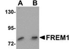 Western blot analysis of FREM1 in K562 cell lysate with FREM1 antibody at (A) 0.