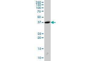 SH3GL2 monoclonal antibody (M01), clone 5A6 Western Blot analysis of SH3GL2 expression in PC-12 . (SH3G2 antibody  (AA 64-124))