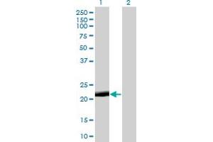 Western Blot analysis of PAGE4 expression in transfected 293T cell line by PAGE4 monoclonal antibody (M01), clone 7C3. (PAGE4 antibody  (AA 1-102))
