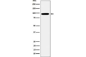 Western blot analysis of Epsin 1 expression in K562 cell lysate.