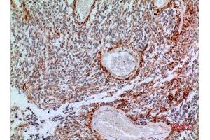 Immunohistochemistry (IHC) image for anti-CD200 (CD200) (Internal Region) antibody (ABIN3187966)