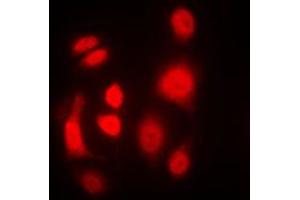 Immunofluorescent analysis of PKR staining in MCF7 cells. (EIF2AK2 antibody  (C-Term))