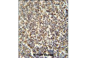 DENND1B antibody immunohistochemistry analysis in formalin fixed and paraffin embedded human lymph tissue followed by peroxidase conjugation of the secondary antibody and DAB staining. (DENND1B antibody  (N-Term))