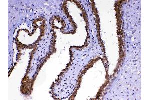 IHC analysis of MED4 using anti-MED4 antibody . (MED4 antibody  (AA 27-140))