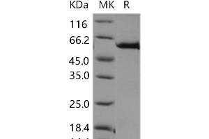 Western Blotting (WB) image for C-Mer Proto-Oncogene Tyrosine Kinase (MERTK) (Active) protein (GST tag,His tag) (ABIN7320009) (MERTK Protein (GST tag,His tag))