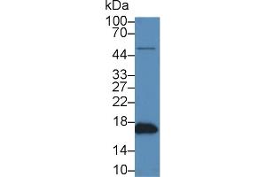 Detection of SOD1 in Human Hela cell lysate using Polyclonal Antibody to Superoxide Dismutase 1 (SOD1)