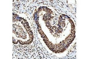 IHC analysis of HNRNPL using anti-HNRNPL antibody (ABIN4886624). (HNRNPL antibody  (C-Term))