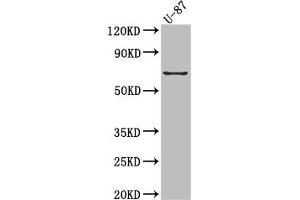 Western Blot Positive WB detected in: U-87 whole cell lysate All lanes: COX2 Antibody at 1:1000 Secondary Goat polyclonal to rabbit IgG at 1/50000 dilution Predicted band size: 69 kDa Observed band size: 69 kDa (Recombinant PTGS2 antibody)