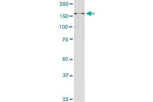 RAI1 monoclonal antibody (M01), clone 6H5. (RAI1 antibody  (AA 1-101))