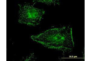 Immunofluorescence (IF) image for anti-Clathrin Interactor 1 (CLINT1) (AA 161-261) antibody (ABIN523164)