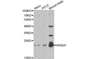 Western blot analysis of extracts of various cell lines, using RAB5A antibody. (RAB5 antibody  (AA 1-215))