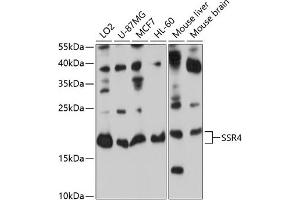 Western blot analysis of extracts of various cell lines, using SSR4 antibody (ABIN6133183, ABIN6148490, ABIN6148491 and ABIN6224060) at 1:1000 dilution. (SSR4 antibody  (AA 24-144))