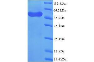 SDS-PAGE (SDS) image for WD Repeat Domain 77 (WDR77) (AA 1-312), (partial) protein (His-SUMO Tag) (ABIN4976252) (WDR77 Protein (AA 1-312, partial) (His-SUMO Tag))