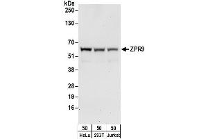 anti-Zinc Finger Protein 622 (ZNF622) (AA 150-200) antibody