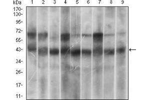 Western blot analysis using MAPK14 mouse mAb against Hela (1), HEK293 (2), A431 (3), MCF-7 (4), RAW264. (MAPK14 antibody  (AA 299-360))