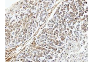 IHC-P Image Immunohistochemical analysis of paraffin-embedded SNU16 xenograft, using TUFM, antibody at 1:100 dilution. (TUFM antibody)