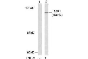 Image no. 2 for anti-Mitogen-Activated Protein Kinase Kinase Kinase 5 (MAP3K5) (pSer83) antibody (ABIN196913) (ASK1 antibody  (pSer83))