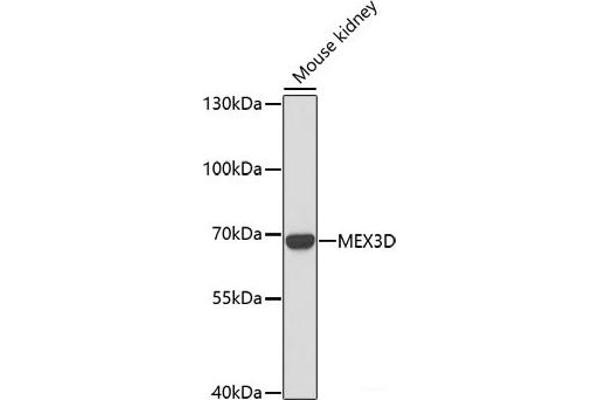MEX3D anticorps