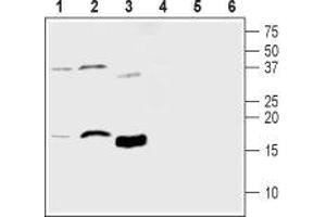 Western blot analysis of mouse brain lysate (lanes 1 and 4), rat brain lysate (lanes 2 and 5) and human recombinant MANF protein (lanes 3 and 6): - 1-3. (MANF antibody  (Mature))