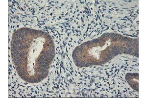 Immunohistochemical staining of paraffin-embedded Human endometrium tissue using anti-CXorf26 mouse monoclonal antibody. (CXorf26 antibody)