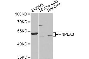 Western blot analysis of extracts of various cell lines, using PNPLA3 Antibody (ABIN2564605) at 1:1000 dilution.