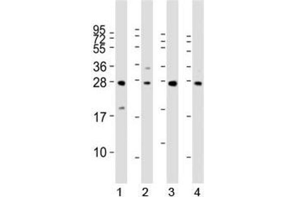 LIN28B antibody  (AA 95-128)