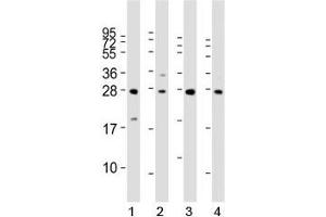 Western blot analysis of LIN28B antibody and 1) HeLa, 2) K562, 3) mouse testis and 4) NCCIT lysate. (LIN28B antibody  (AA 95-128))