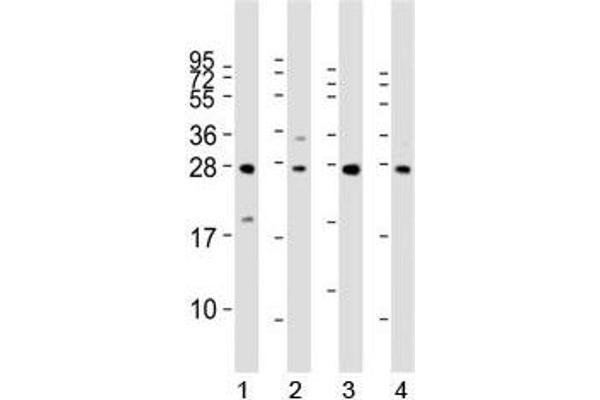 LIN28B 抗体  (AA 95-128)