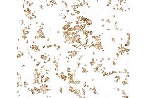 Immunocytochemistry (ICC) image for anti-Metadherin (MTDH) (AA 475-525) antibody (ABIN7795652)