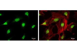 ICC/IF Image CDK4 antibody detects CDK4 protein at nucleus by immunofluorescent analysis. (CDK4 antibody)