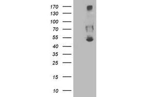 HEK293T cells were transfected with the pCMV6-ENTRY control (Left lane) or pCMV6-ENTRY SHPK (Right lane) cDNA for 48 hrs and lysed. (SHPK antibody)