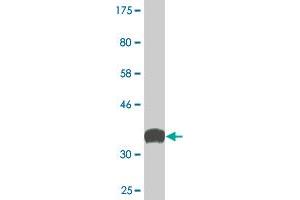 Western Blot detection against Immunogen (36. (Synaptojanin 1 antibody  (AA 1474-1573))