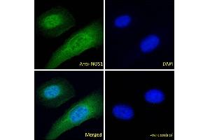 ABIN184662 Immunofluorescence analysis of paraformaldehyde fixed U2OS cells, permeabilized with 0. (NOS1 antibody  (C-Term))