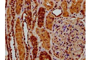 IHC image of ABIN7174060 diluted at 1:200 and staining in paraffin-embedded human kidney tissue performed on a Leica BondTM system. (RYK antibody  (AA 494-586))