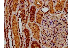 IHC image of ABIN7174060 diluted at 1:200 and staining in paraffin-embedded human kidney tissue performed on a Leica BondTM system.