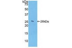 Detection of Recombinant FCN1, Human using Polyclonal Antibody to Ficolin 1 (FCN1) (FCN1 antibody  (AA 45-249))