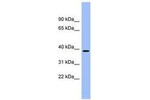 Image no. 1 for anti-Aminocarboxymuconate Semialdehyde Decarboxylase (ACMSD) (AA 251-300) antibody (ABIN6743386)